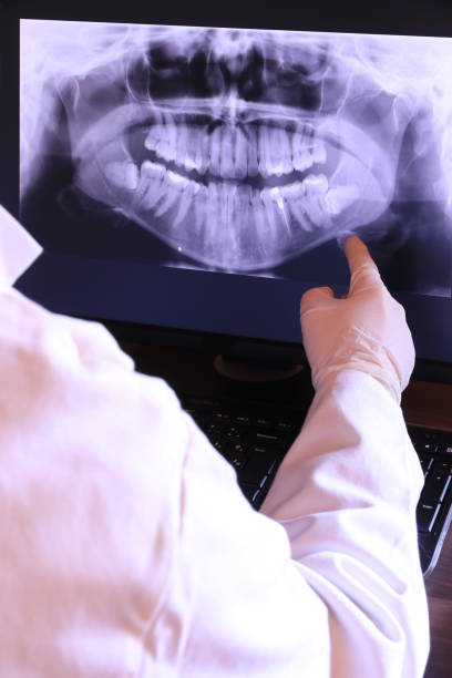 Best Emergency Denture Repair in Lake Katrine, NY