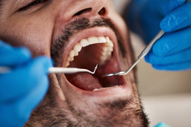 Best Emergency Dental Care for Sports Injuries in Lake Katrine, NY