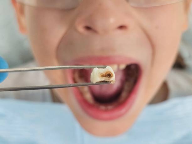 Best Broken or Chipped Tooth Repair in Lake Katrine, NY